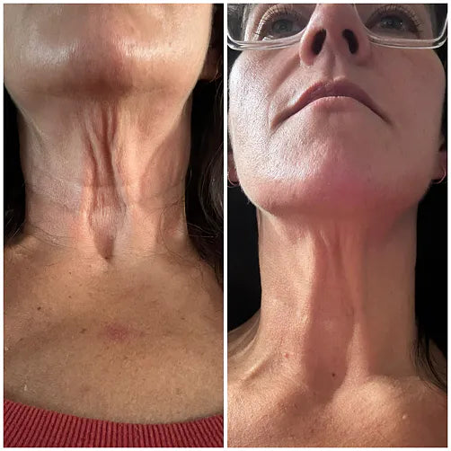 Dryness looks less obvious on my neck